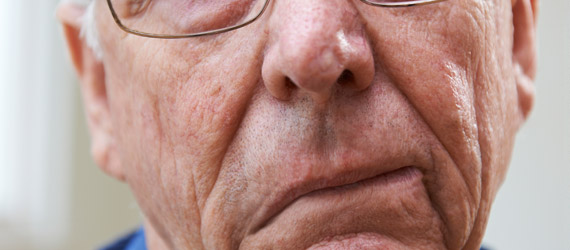 Parálisis o derrame facial