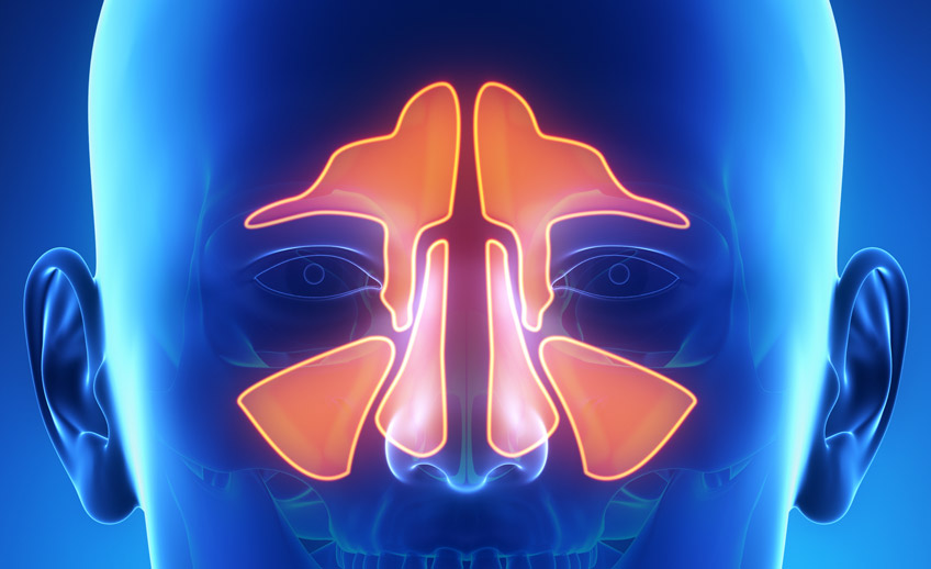 Alergias, rinitis y sinusitis